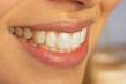 אסתטיקה  ו SMILE DESIGN